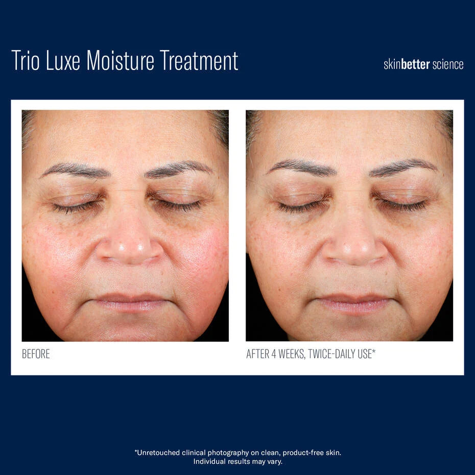 Trio Luxe Moisture Treatment